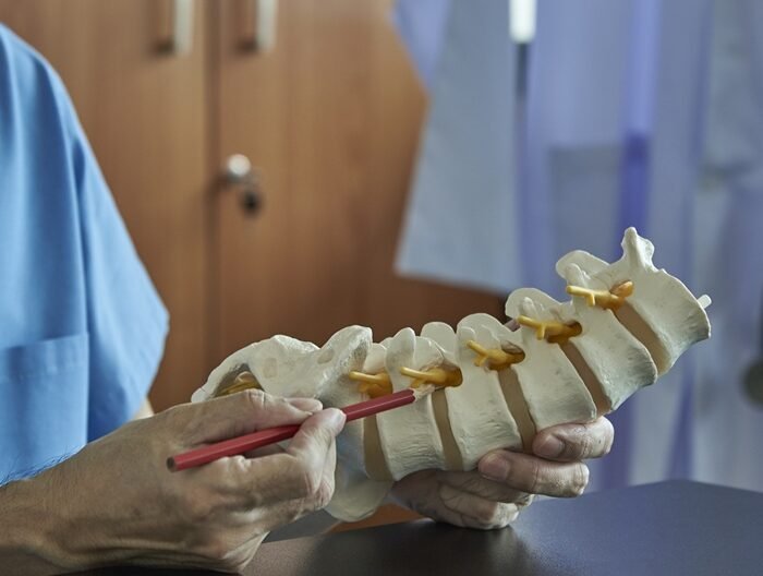 Understanding Foraminotomy: A Minimally Invasive Way to Treat Nerve Pain